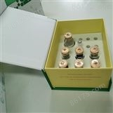 辅酶Ⅰ/NADP苹果酸脱氢酶(NADP-MDH)测试盒